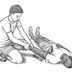 How to Treat a Dislocated Shoulder Without a Doctor