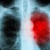 The Way You Walk Can Predict Your Risk of Death from Heart Disease—Here's Why