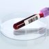 A Simple New Test Is Identifying Up to 100% of Early-Stage Cancer Cases